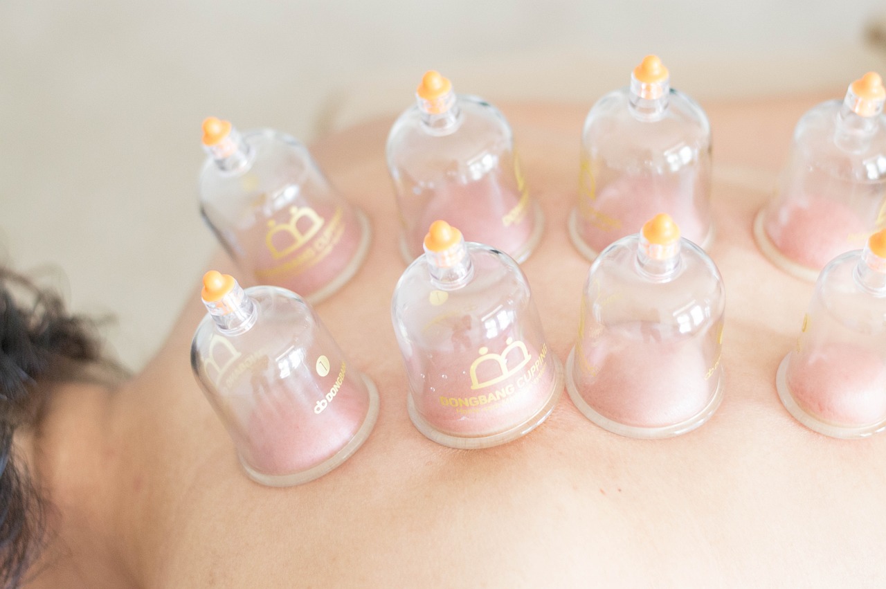 massage cupping